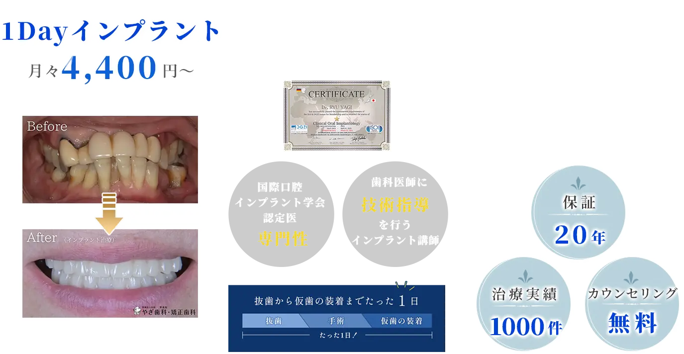 1Dayインプラント対応医院