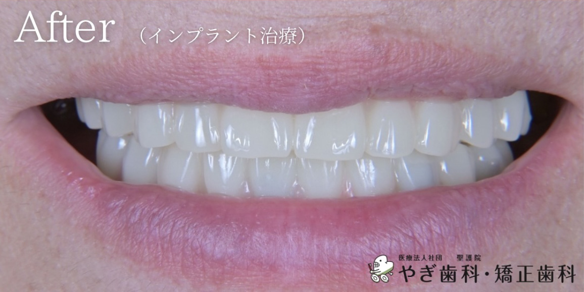 アフター写真03