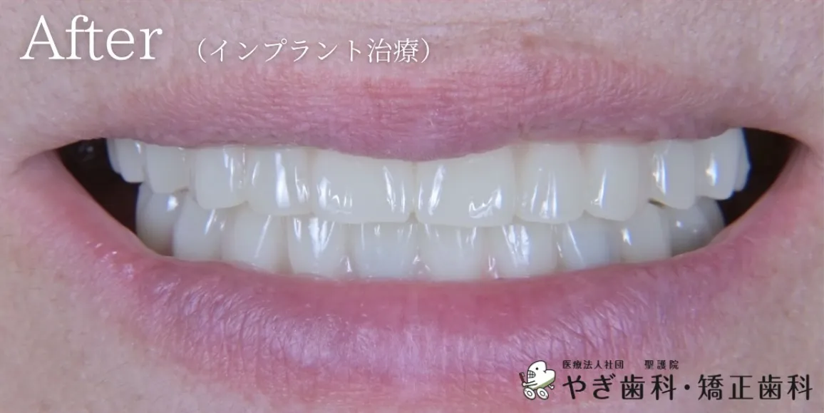 アフター写真03