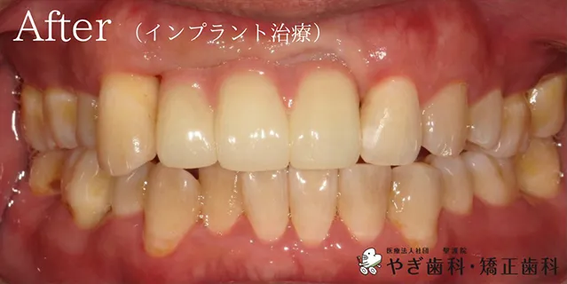 アフター写真01