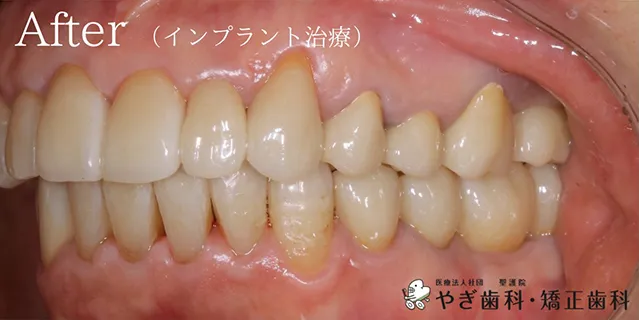 アフター写真02