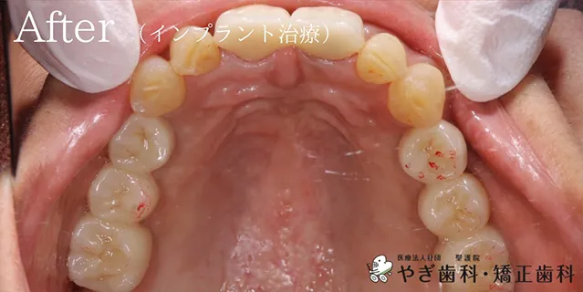 アフター写真03