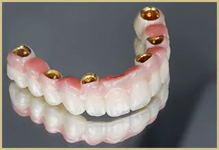 Auro Galvano Crown（AGC）