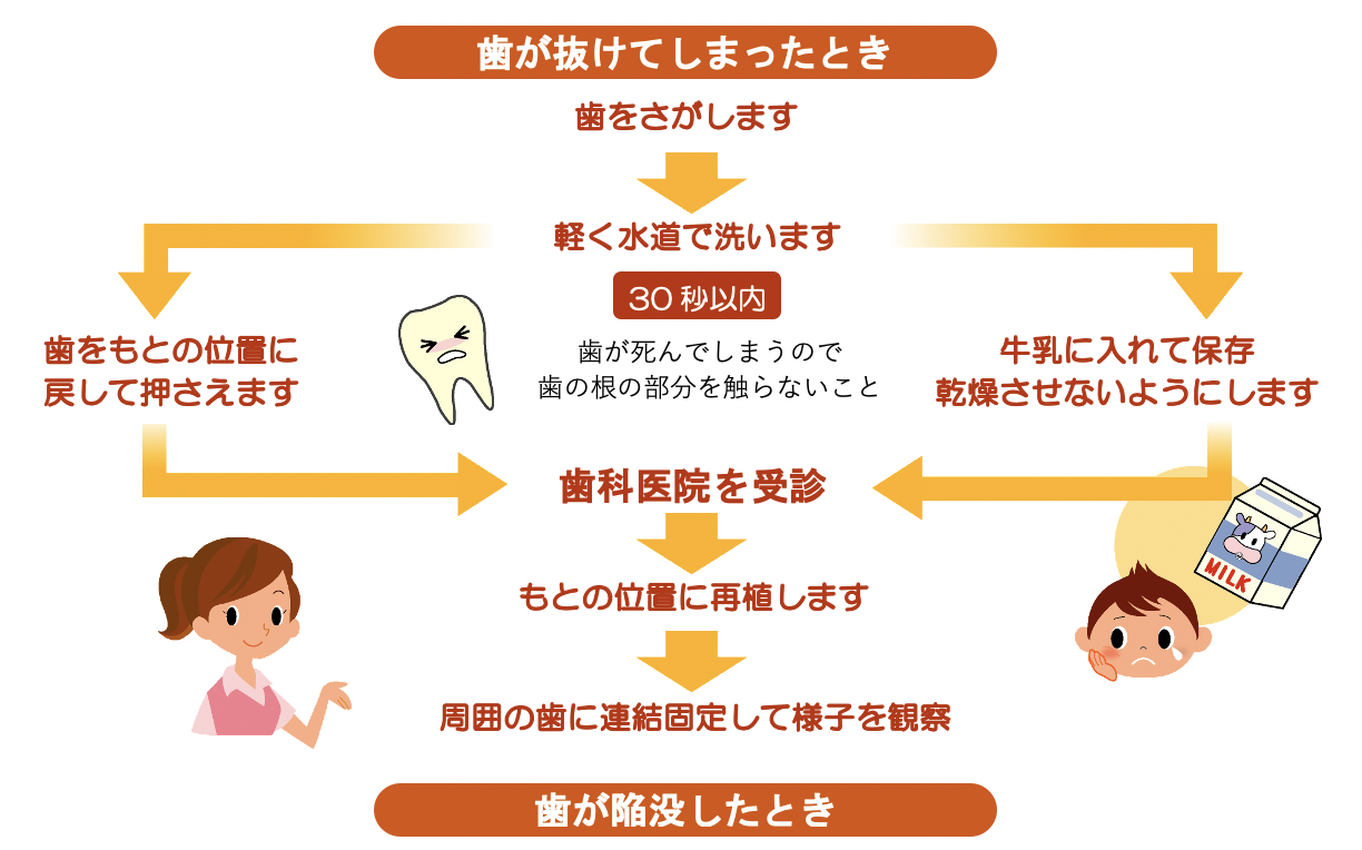 歯 が 抜け た 時 の 対処 法